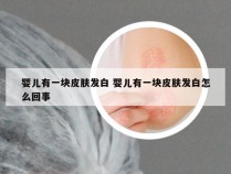 婴儿有一块皮肤发白 婴儿有一块皮肤发白怎么回事