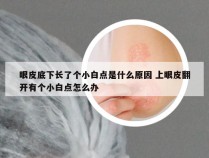 眼皮底下长了个小白点是什么原因 上眼皮翻开有个小白点怎么办