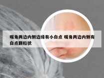 嘴角两边内侧边缘有小白点 嘴角两边内侧有白点颗粒状