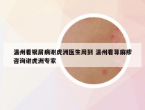 温州看银屑病谢虎洲医生周到 温州看荨麻疹咨询谢虎洲专家