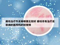 廊坊治疗牛皮癣哪里比较好 廊坊市有治疗皮肤病的医院吗的短视频