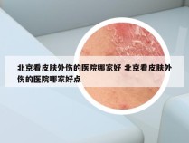 北京看皮肤外伤的医院哪家好 北京看皮肤外伤的医院哪家好点