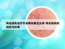 鸡毛烧灰治疗牛皮癣效果怎么样 鸡毛烧灰的功效与妙用