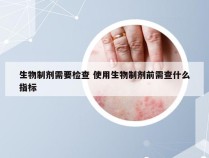 生物制剂需要检查 使用生物制剂前需查什么指标