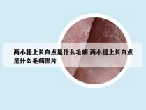 两小腿上长白点是什么毛病 两小腿上长白点是什么毛病图片