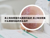 身上有白斑是什么原因引起的 身上有白斑是什么原因引起的怎么治疗