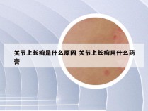 关节上长癣是什么原因 关节上长癣用什么药膏