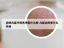 边缘凸起中间光滑是什么癣 凸起边缘有什么作用