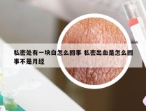 私密处有一块白怎么回事 私密出血是怎么回事不是月经