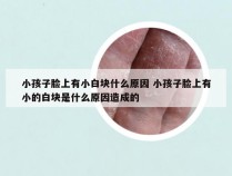 小孩子脸上有小白块什么原因 小孩子脸上有小的白块是什么原因造成的