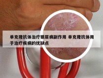 单克隆抗体治疗银屑病副作用 单克隆抗体用于治疗疾病的优缺点