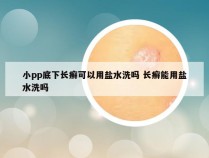 小pp底下长癣可以用盐水洗吗 长癣能用盐水洗吗