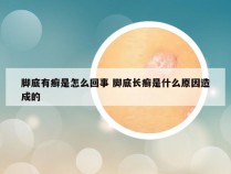 脚底有癣是怎么回事 脚底长癣是什么原因造成的