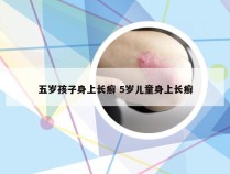 五岁孩子身上长癣 5岁儿童身上长癣