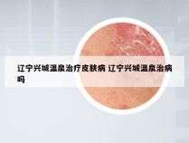 辽宁兴城温泉治疗皮肤病 辽宁兴城温泉治病吗