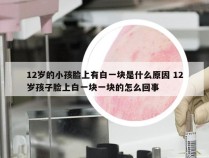 12岁的小孩脸上有白一块是什么原因 12岁孩子脸上白一块一块的怎么回事