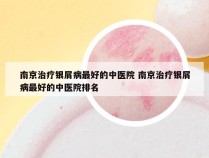 南京治疗银屑病最好的中医院 南京治疗银屑病最好的中医院排名