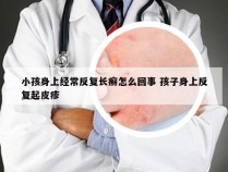 小孩身上经常反复长癣怎么回事 孩子身上反复起皮疹