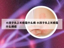 小孩子头上长癣是什么病 小孩子头上长癣是什么病症