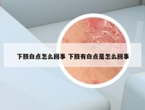 下肢白点怎么回事 下肢有白点是怎么回事