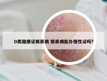 D类健康证银屑病 银屑病能办慢性证吗?