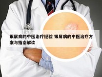 银屑病的中医治疗经验 银屑病的中医治疗方案与指南解读