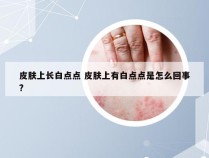 皮肤上长白点点 皮肤上有白点点是怎么回事?