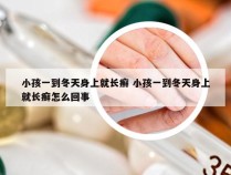 小孩一到冬天身上就长癣 小孩一到冬天身上就长癣怎么回事