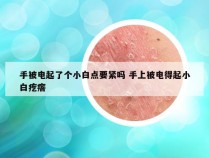 手被电起了个小白点要紧吗 手上被电得起小白疙瘩