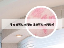 牛皮癣可以吃阿胶 湿疹可以吃阿胶吗