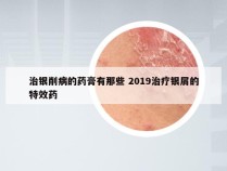 治银削病的药膏有那些 2019治疗银屑的特效药