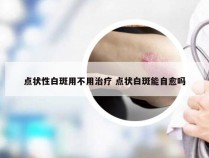 点状性白斑用不用治疗 点状白斑能自愈吗