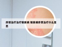 序惯治疗治疗银屑病 银屑病序贯治疗什么意思