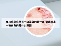 女孩脸上突然有一块发白的是什么 女孩脸上一块白白的是什么原因