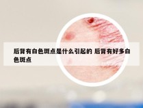 后背有白色斑点是什么引起的 后背有好多白色斑点