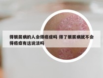 得银屑病的人会得癌症吗 得了银屑病就不会得癌症有这说法吗