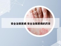 安全治银屑病 安全治银屑病的药膏