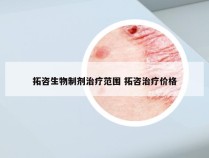 拓咨生物制剂治疗范围 拓咨治疗价格