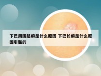 下巴周围起癣是什么原因 下巴长癣是什么原因引起的