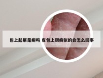 包上起屑是癣吗 皮包上跟癣似的会怎么回事