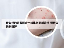 什么样的患者适合一线生物制剂治疗 哪种生物制剂好