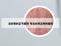 治白斑的正亏医院 专治白斑正规的医院