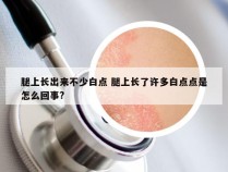 腿上长出来不少白点 腿上长了许多白点点是怎么回事?