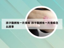 孩子胳膊有一片像癣 孩子胳膊有一片像癣怎么回事