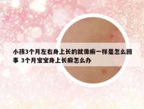 小孩3个月左右身上长的就像癣一样是怎么回事 3个月宝宝身上长癣怎么办