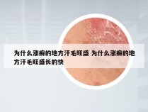 为什么涨癣的地方汗毛旺盛 为什么涨癣的地方汗毛旺盛长的快