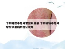 下列哪些不是寻常型银屑病 下列哪项不是寻常型银屑病的特征现象