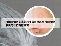 打银屑病关节炎新冠疫苗有禁忌吗 银屑病关节炎可以打新冠疫苗