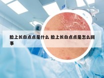 脸上长白点点是什么 脸上长白点点是怎么回事