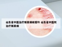 山东省中医治疗银屑病胡爱玲 山东省中医院治疗银屑病